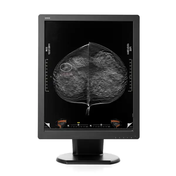 Colour digital mammography DICOM diagnsotic display