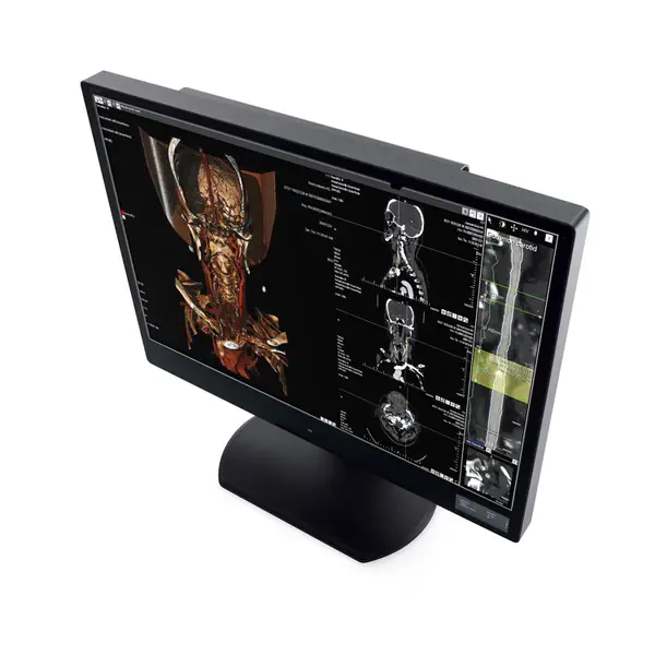 Digital DICOM Diagnostic colour medical display. Digital multi-modality colour medical DICOM diagnostic display.