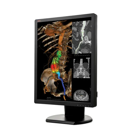 Diagnostic colour DICOM medical display. Colour DICOM diagnostic display for medical use.