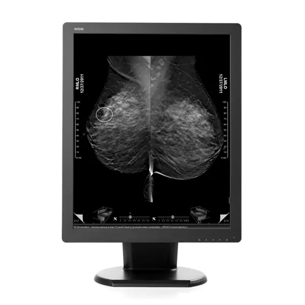 A digital mammography diagnostic DICOM monitor and a digital tomography diagnostic DICOM display