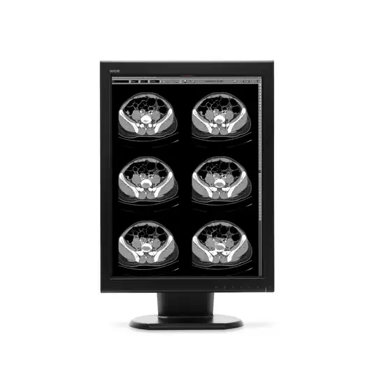 2 Mega Pixed DICOm diagnostic grayscale display. Diagnostic X-ray screen. DICOM Diagnostic Monochrome Display.