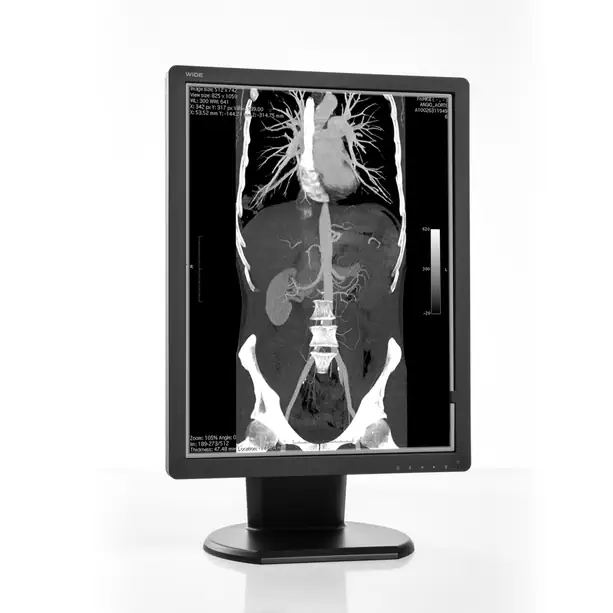 DICOM greyscale diagnostic medical display. DICOM monochrome diagnostic medical display.